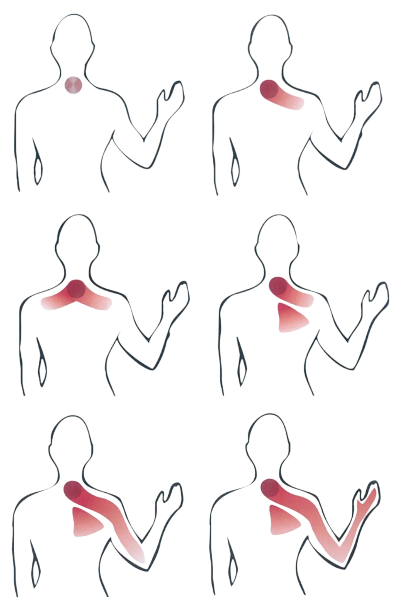 Neck and Upper Back Pain diagram